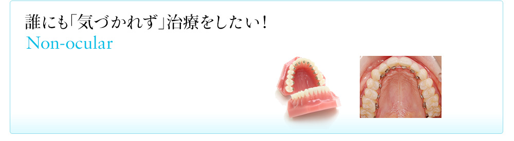 「見えない・目立たない矯正」－誰にも気づかれず治療をしたい！ Non-ocular 